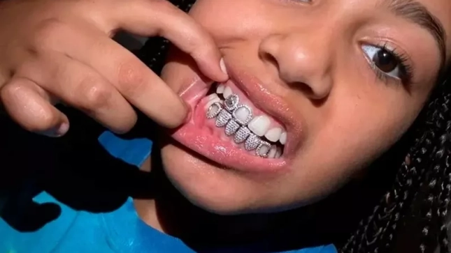 North West y sus dientes