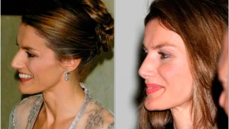 ReinaLetizia antes y después