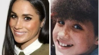 El cambio de Meghan Markle en su nariz